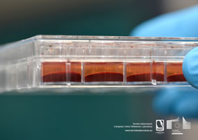Blood with anticoagulant after centrifugation (blood cells at the bottom and plasma at the top)