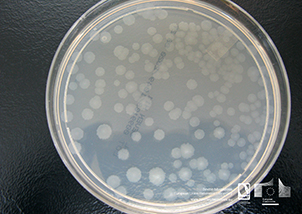 Mycobacterium bovis colonies in Middlebrook 7H11 culture medium