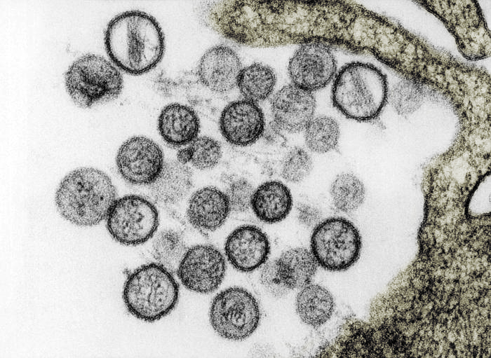 Part&iacute;culas v&iacute;ricas del Virus Sin Nombre (SNV). Microscop&iacute;a electr&oacute;nica de transmisi&oacute;n. CDC.