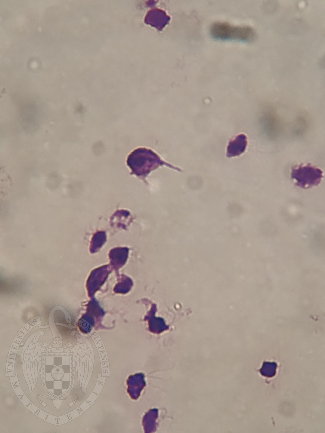 trypanosoma Trichomonas)