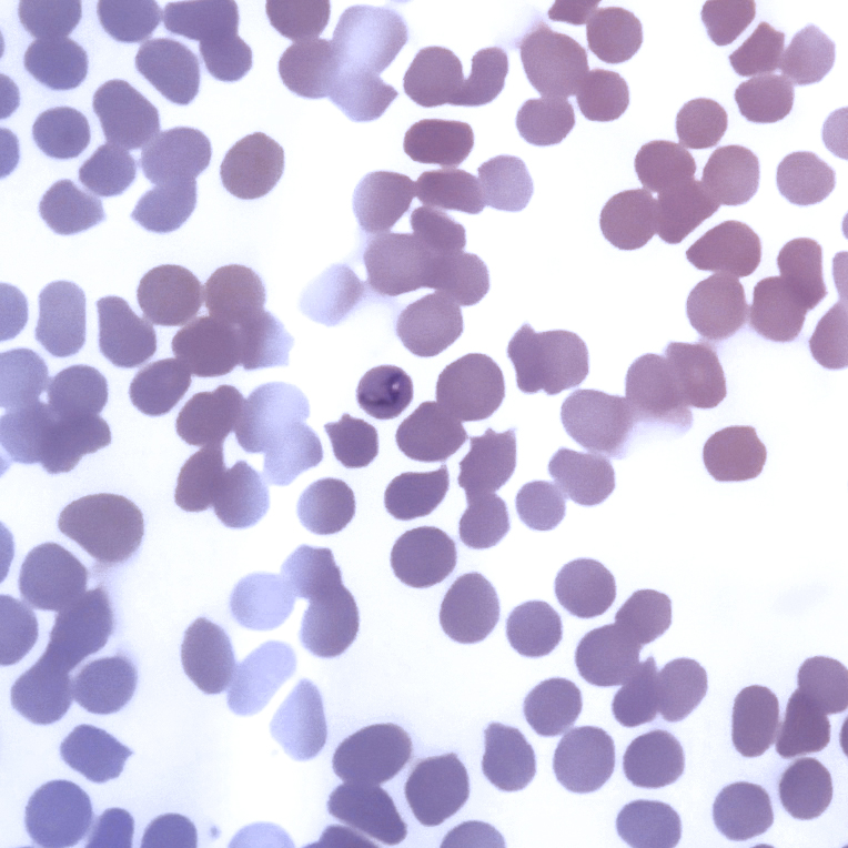 Frotis sanguíneo con Babesia caballi Piroplasmosis equina