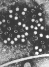 TEM micrograph of hepatitis E virions (CDC)