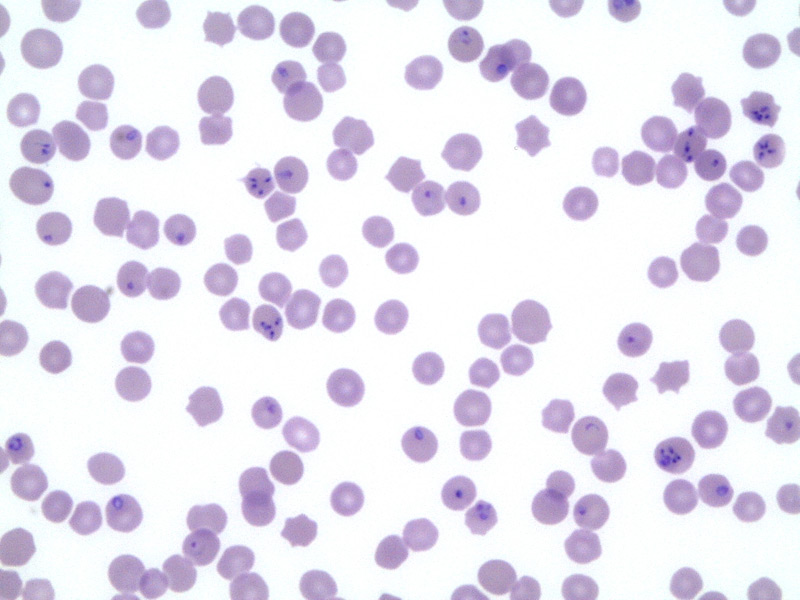 Theileria equi Blood smear, Equine Piroplasmosis